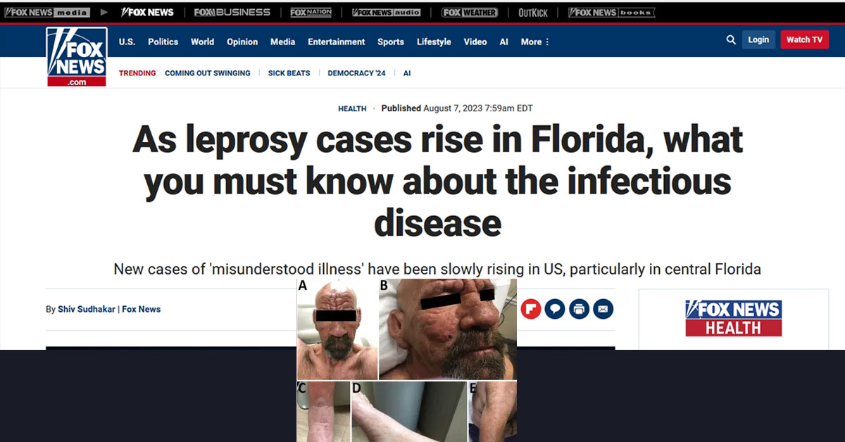 Is It Now Time To Escape From Florida Due To Outbreak Of Leprosy And Malaria?